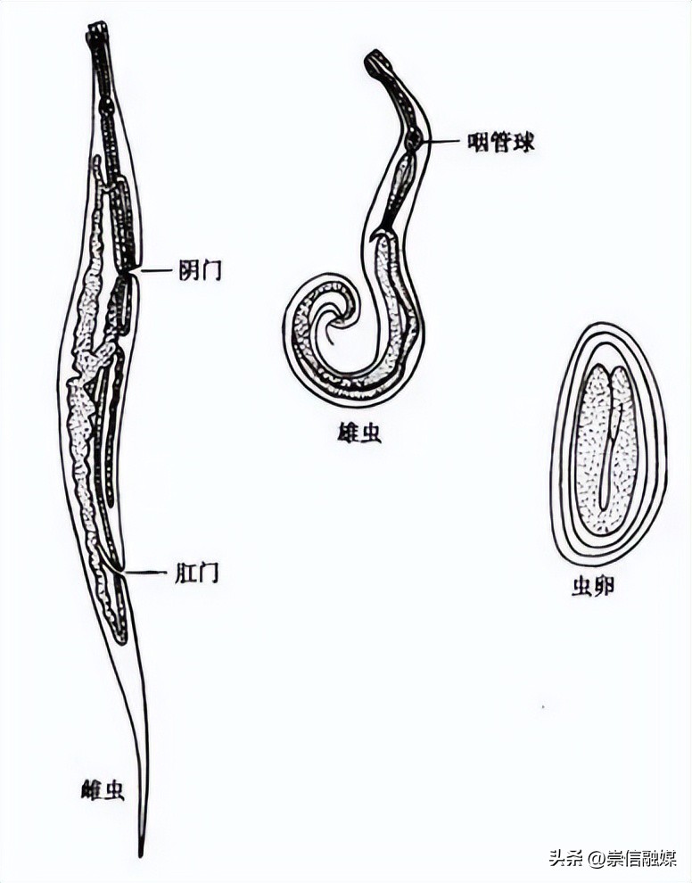 屁股有虫痒是什么虫病,小孩经常屁股痒是不是肚子有虫