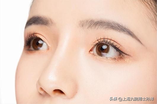 埋线双眼皮埋线痕迹明显怎么办,埋线双眼皮开线了会变成什么样子