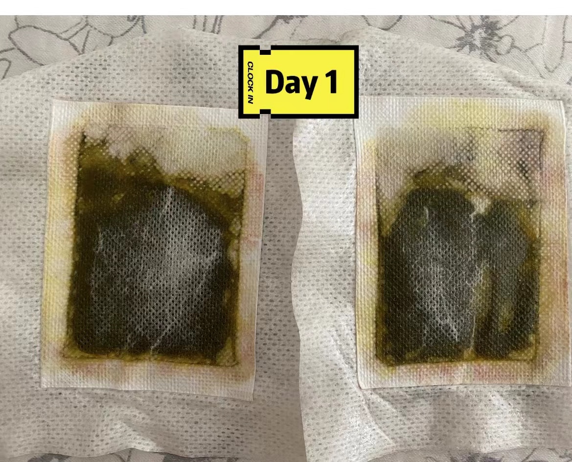 足贴真的可以祛湿气吗减肚子吗,老北京足贴变黑真的排湿气吗