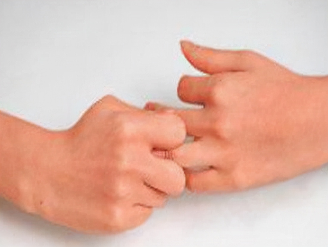 更年期女性手指腱鞘炎,女性绝经易患屈指腱鞘炎吗