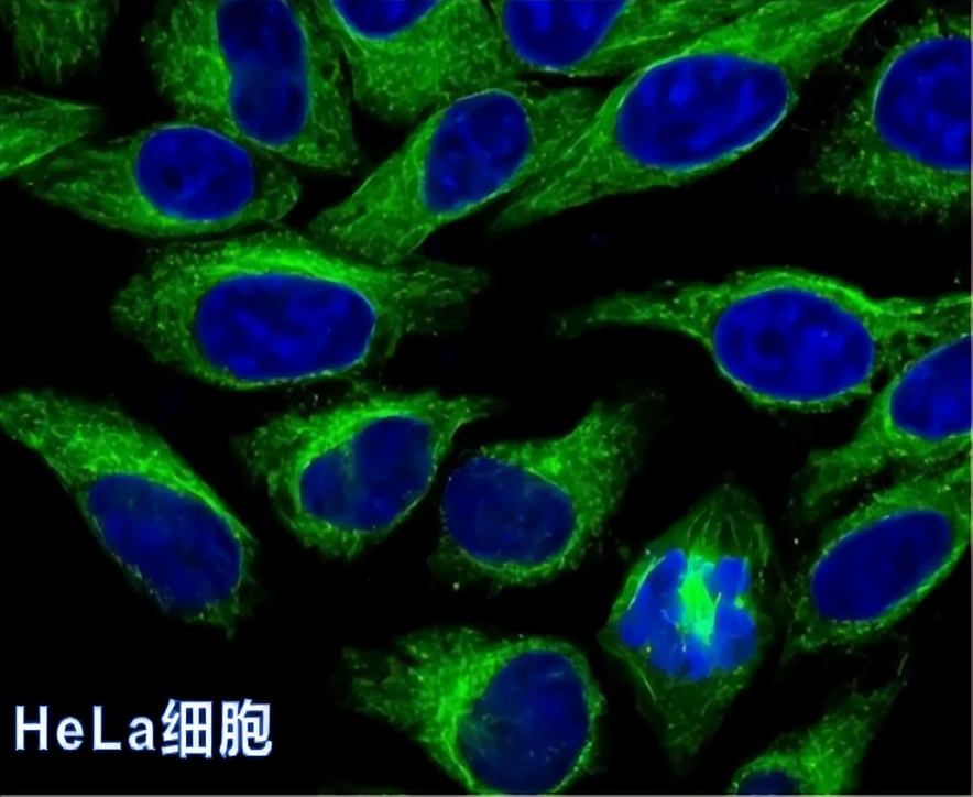 hela细胞复苏步骤,hela细胞是什么细胞