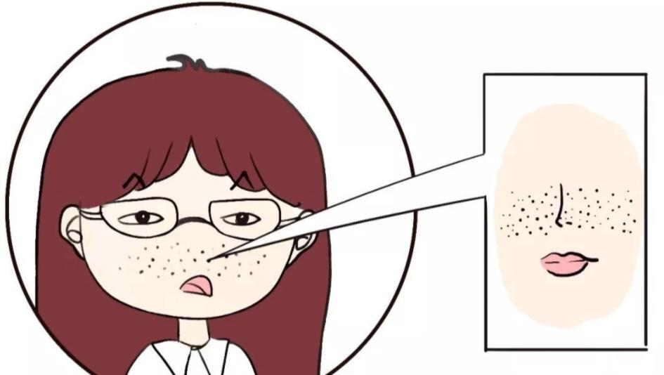 胡子毛孔粗大怎么缩小,毛孔粗大怎么快速缩小