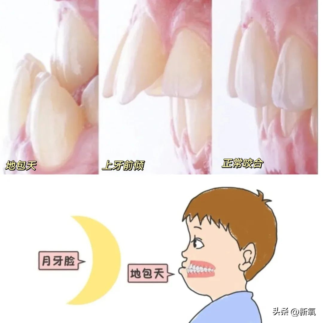 你觉得牙齿对人的颜值影响大吗,牙齿会不会影响你的颜值