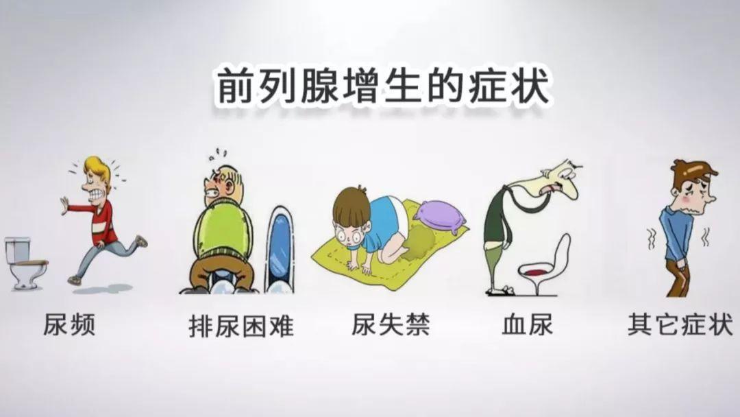 前列腺增生克星中成药原理,前列腺增生克星中成药