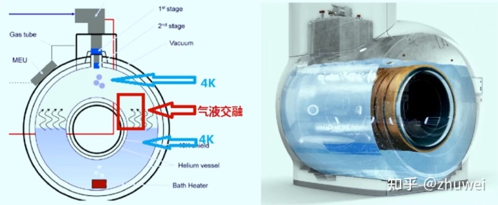 飞利浦推出新一代无液氦磁共振,飞利浦1.5t磁共振系统介绍