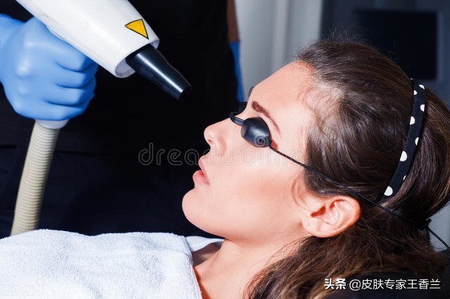 女人脸上常见的几种斑,女性朋友脸上有斑用什么护肤品