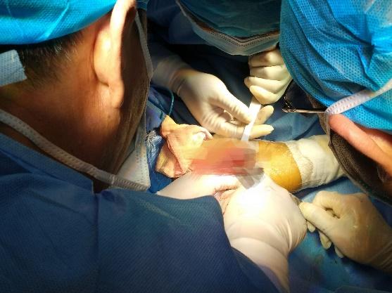 优秀！重庆两江新区中医院年度十佳技术出炉！