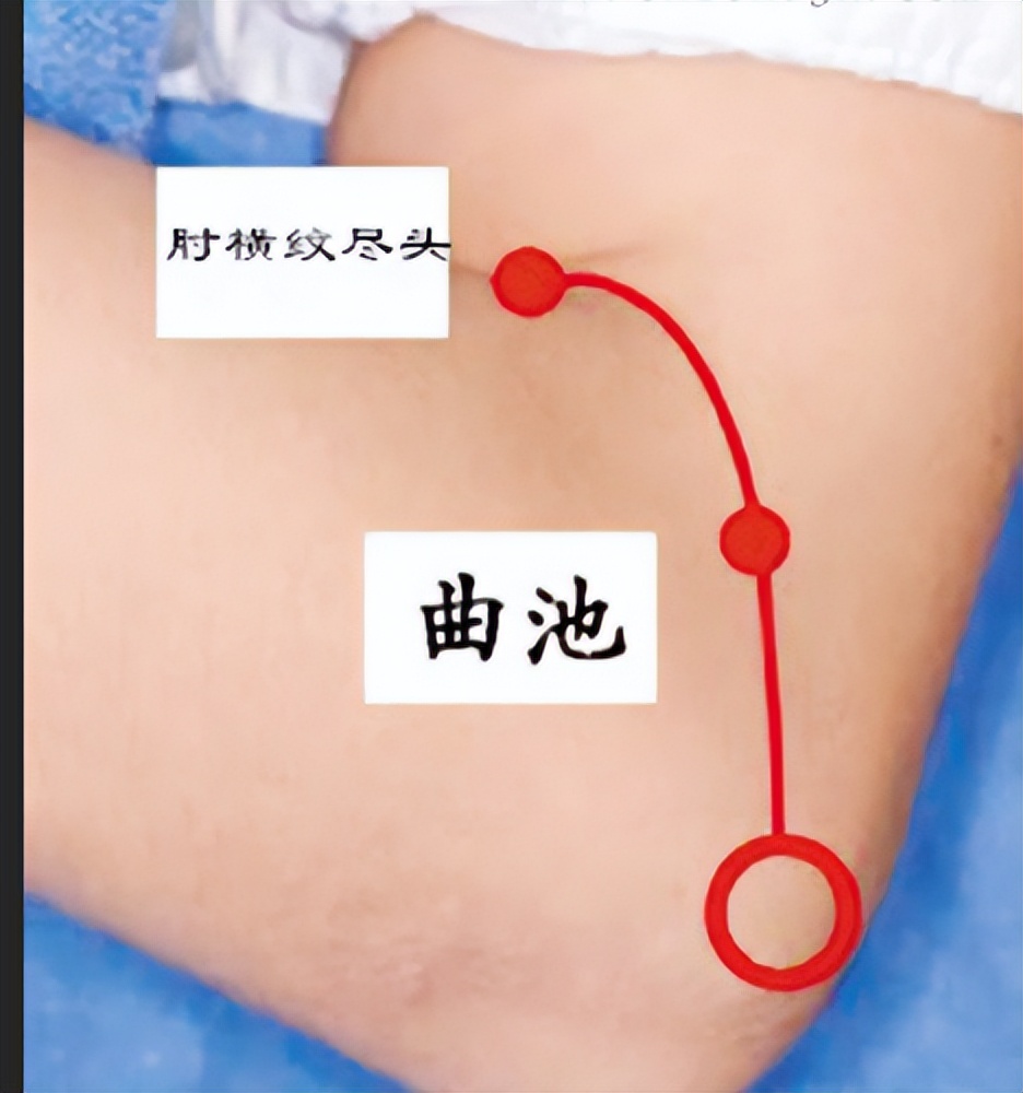 曲池穴有祛湿热的作用吗,消水肿的方法曲池穴