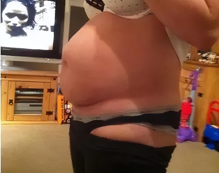 产后三个月能练刘畊宏吗,剖腹产多久可以练刘畊宏减肥操