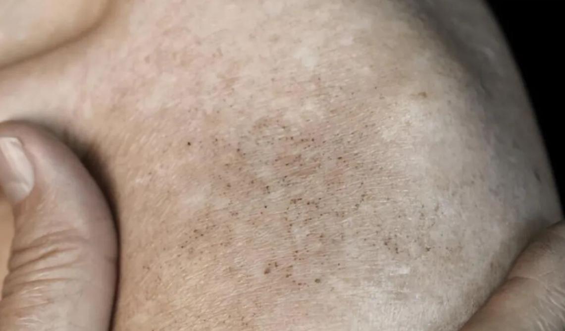 女性腹股沟发黑是什么原因怎么办,女性月经发黑成块状是什么原因