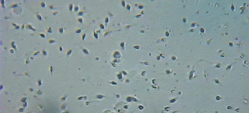 精子的生命力有多强大,精子的8大秘密