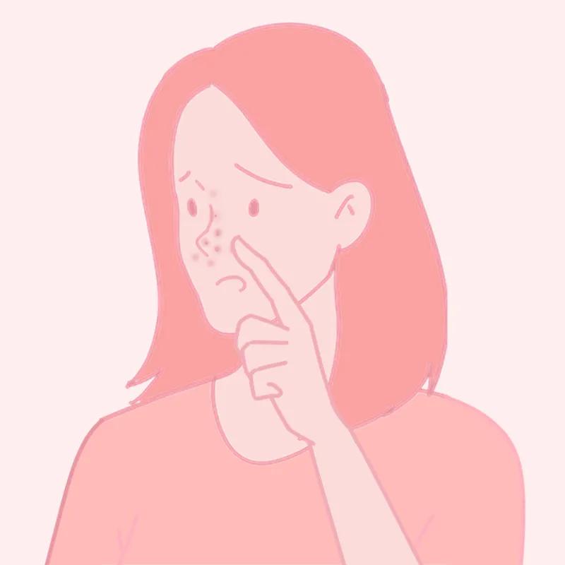 面部危险三角区反复起痘痘怎么办,脸颊周围痘痘的正确消除方法