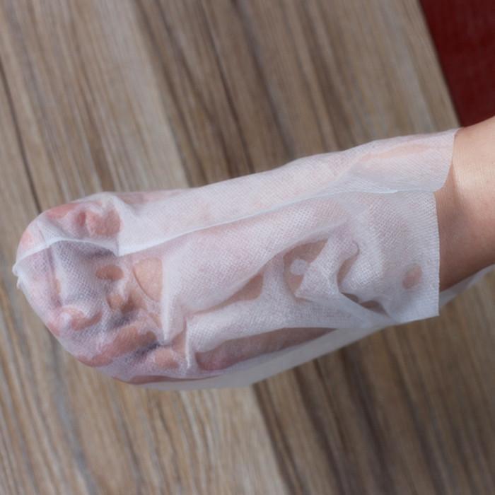 维a酸乳膏可以改善毛孔粗大吗,油皮毛孔粗大黑头多要怎么改善