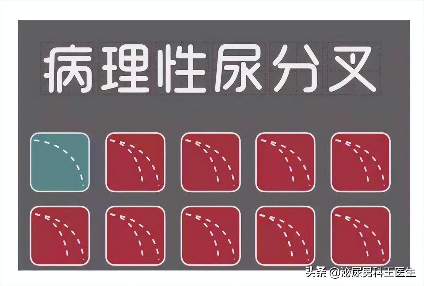 拉小便总是分叉男性,男性小便分叉怎么治疗