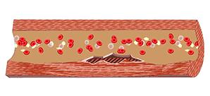 这根血管连通大脑最容易堵!很多人半身不遂后才发现!不看后悔!