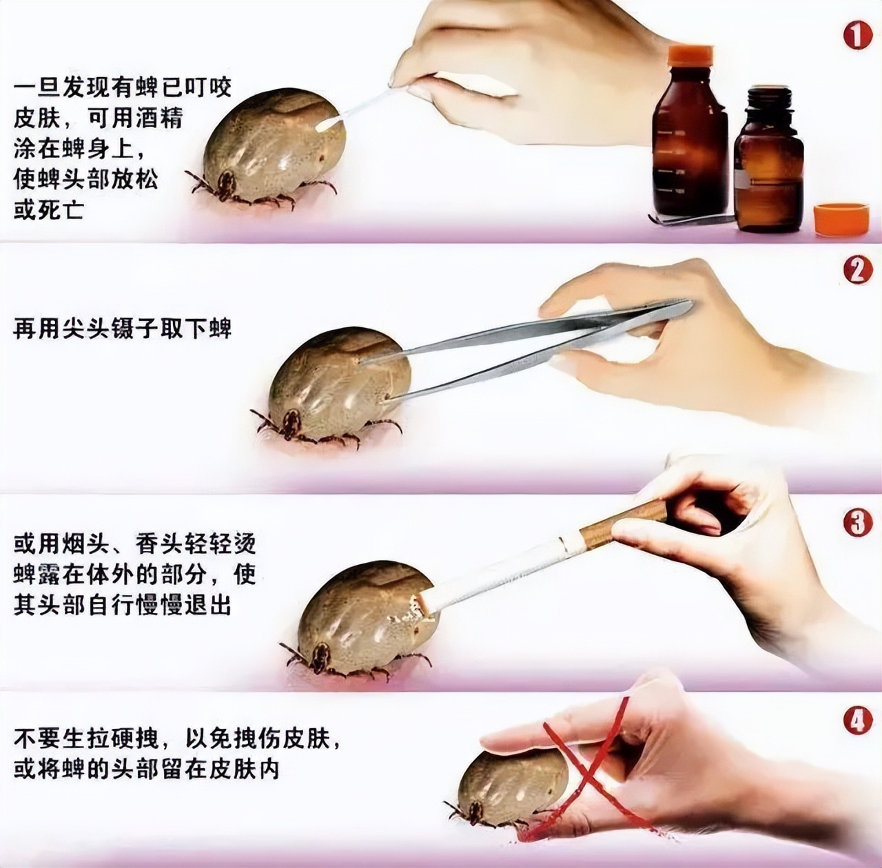 小孩被蜱虫咬了能活多久,孩子被蜱虫咬了三天