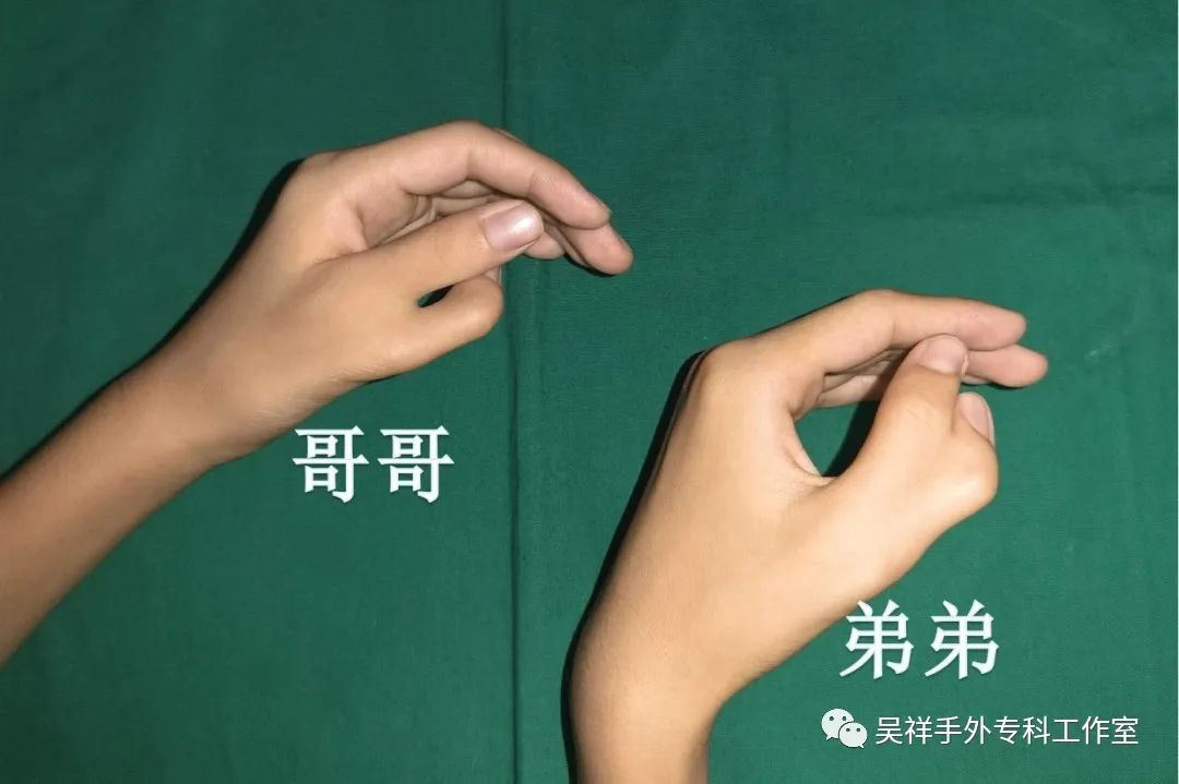 罕见同卵不同性别的双胞胎,罕见四胞胎长得一模一样