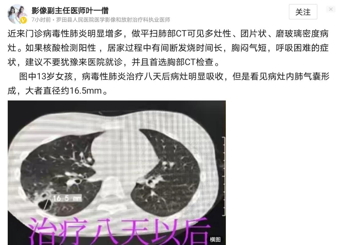 新冠肺炎现在更名成什么了,新冠肺炎为啥改名