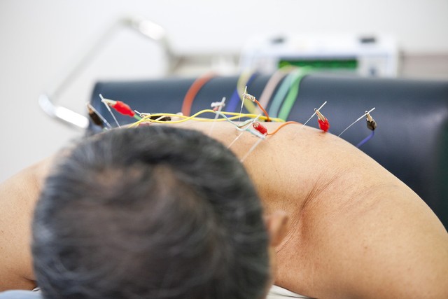 中医认为腰间盘突出的原因是什么,腰椎间盘突出没有症状要理疗吗