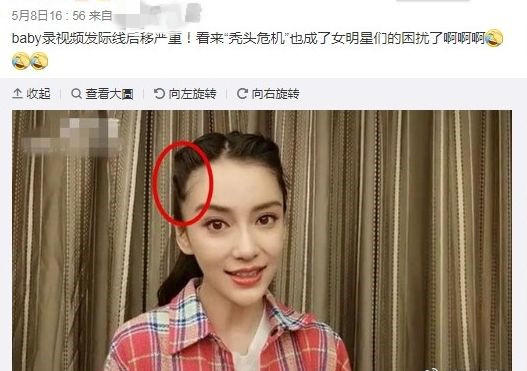 盘点女明星发际线危机,女明星秃头前后对比