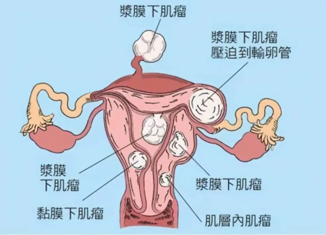 月经突然大出血到休克,月经大出血抢救成功几率