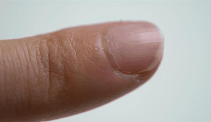 手指长倒刺缺乏哪种维生素,宝宝手指倒刺是缺什么维生素