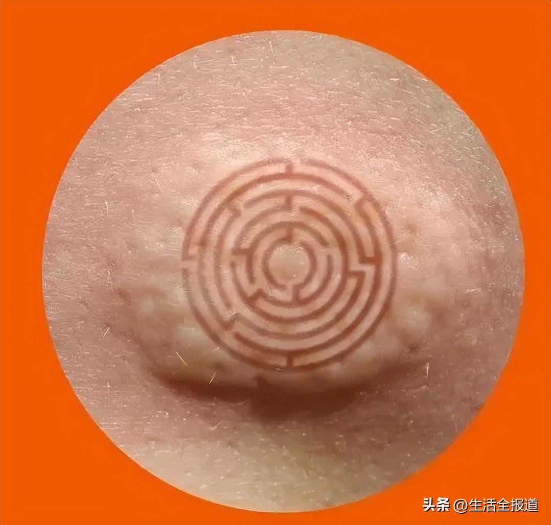 有什么老方法可以快速止痒蚊子包,怎么给蚊子包止痒