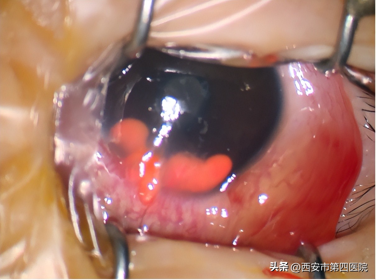 健康中国行动2023与营养相关内容,健康中国行动2019-2030