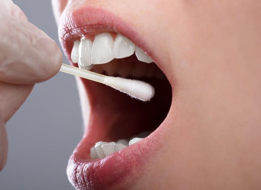 口腔扁平苔藓是中药好还是西药好,中药可以彻底治愈口腔扁平苔藓吗