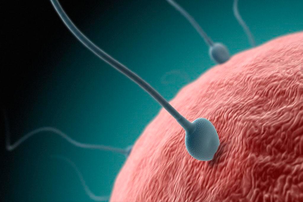 精子变黄什么原因引起的,精子变黄的病因