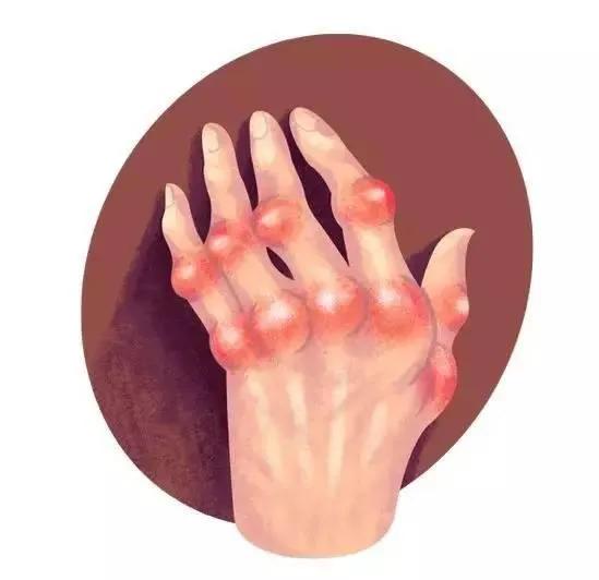 “强的松”功能强大，价格便宜，为什么人们对它却很忌讳