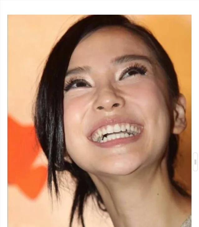 怎么不整容就能成为小v脸,不用整容也能变v脸吗