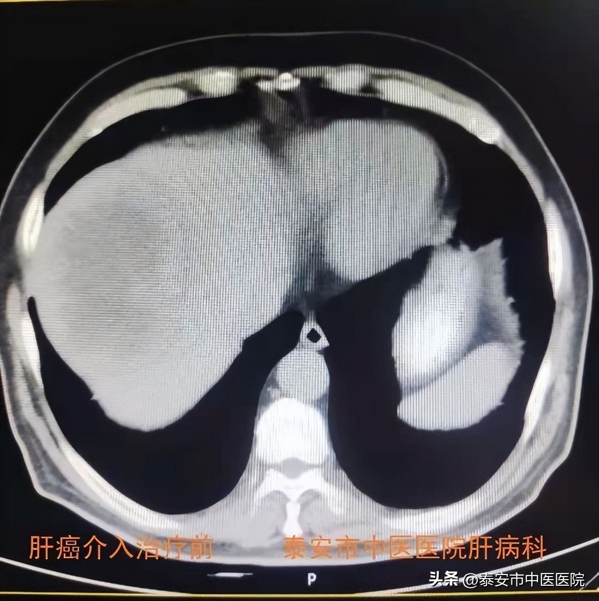 医心向党踔厉奋进直播,医心向党致敬医师节