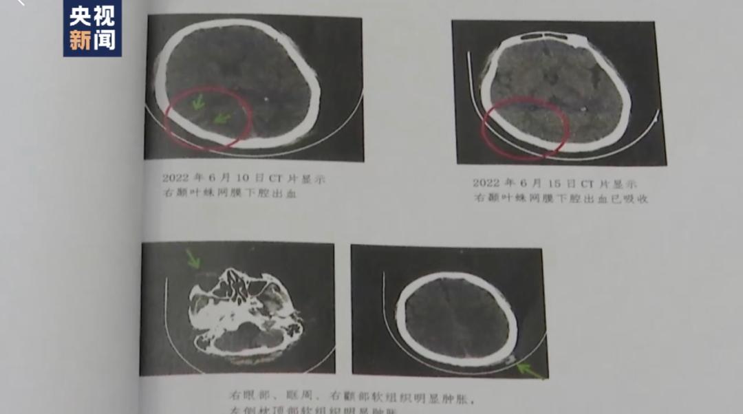 唐山打人案保护伞马爱军获刑12年,唐山打人案“保护伞”被捕
