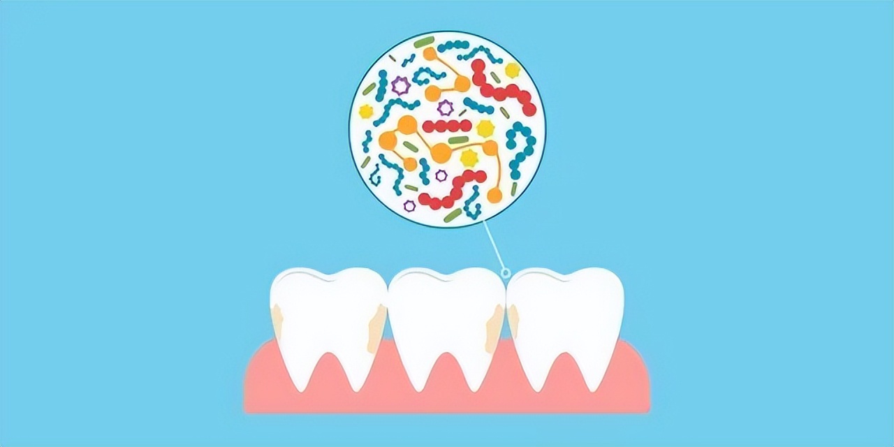 口腔菌群是什么,口腔微生物的世界