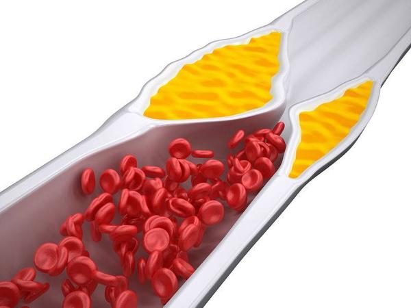 经常吃红薯叶子能抗癌抗三高,吃红薯能降三高吗