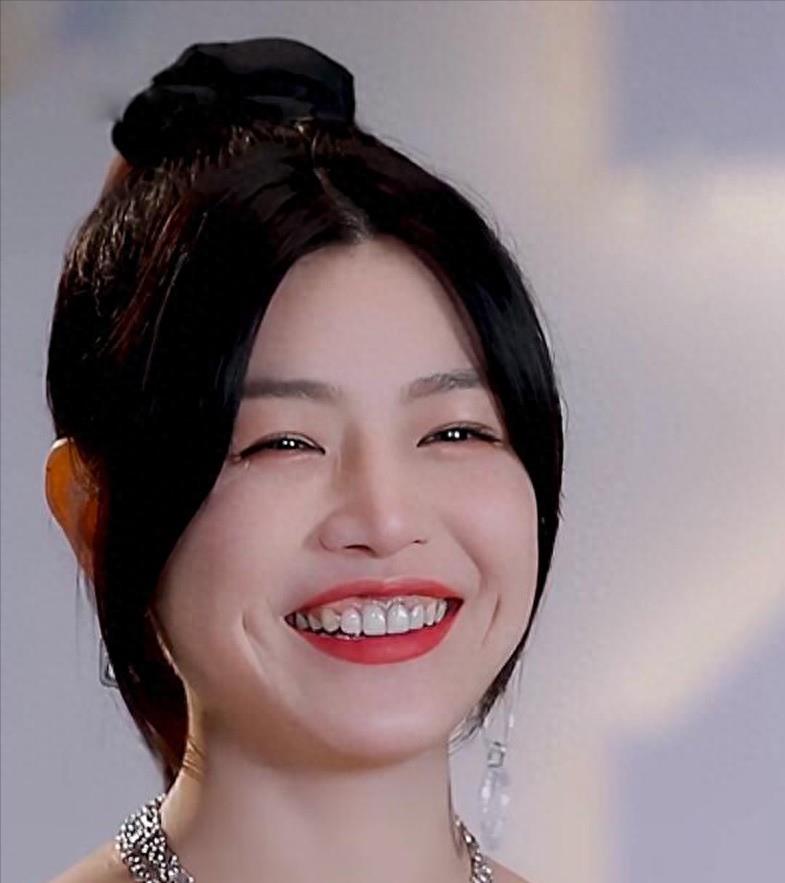 明星烤瓷牙发黑,明星烤瓷牙牙齿磨小后照片