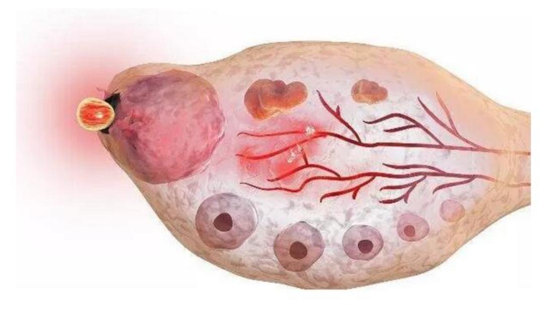 注意性缺陷多动障碍临床表现,注意功能障碍属于什么障碍
