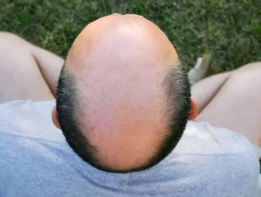 男生手指细长和个子有关吗,男性和女性的手指长短