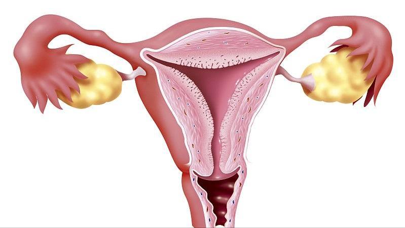 一度宫颈糜烂严重吗需要怎么治疗,有一点轻微宫颈糜烂要不要紧