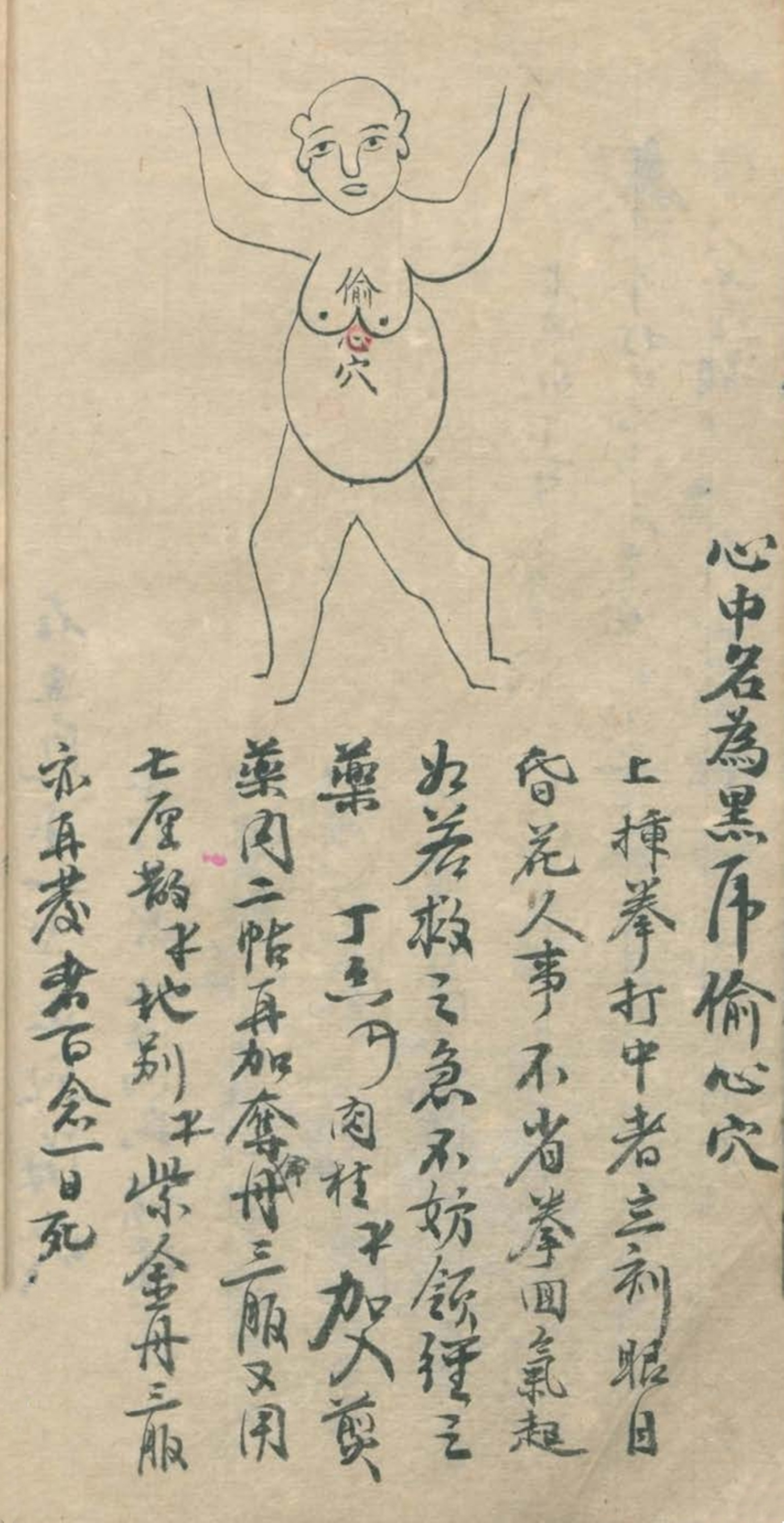 最实用的跌打药方,祖传跌打秘方100首