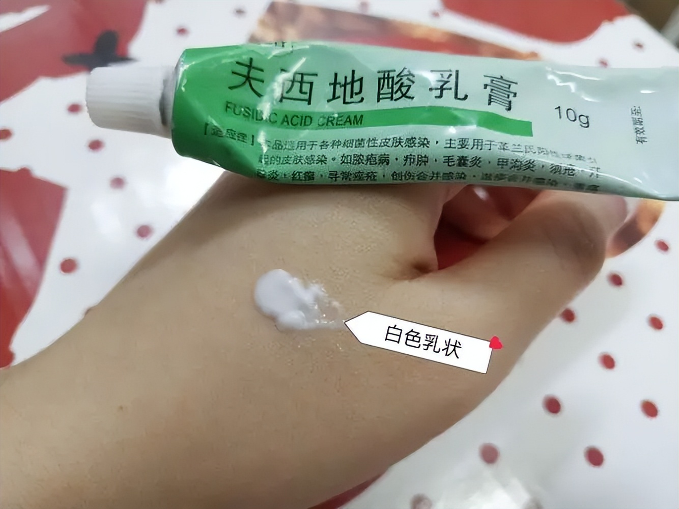 针灸治疗神经性皮炎,异位性皮炎艾灸