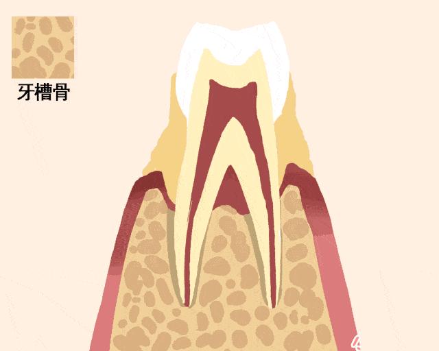 牙齿松动医生说周围没骨头怎么办,牙齿发黑断裂松动医生建议拔掉