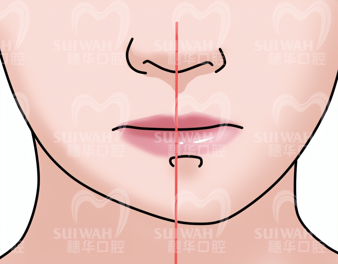 孩子牙畸形,要做矫正吗?暨大穗华口腔提醒这8点别忽视