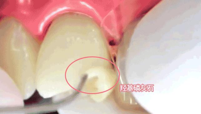 牙黄防口臭清除口腔异味的牙膏,专治牙黄口臭的牙膏正品云南白药