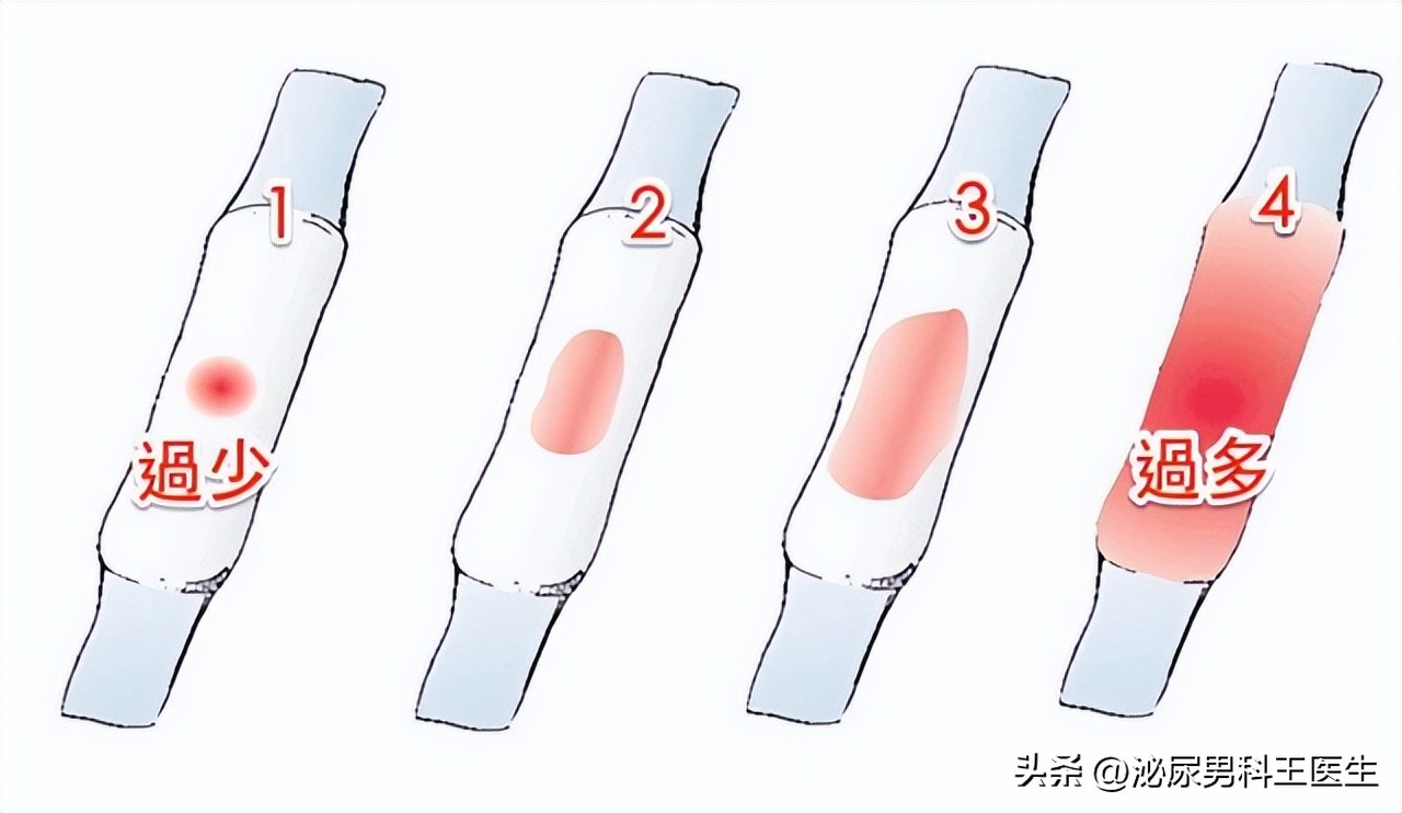 大部分女性都会长子宫肌瘤吗,如何防止长子宫肌瘤