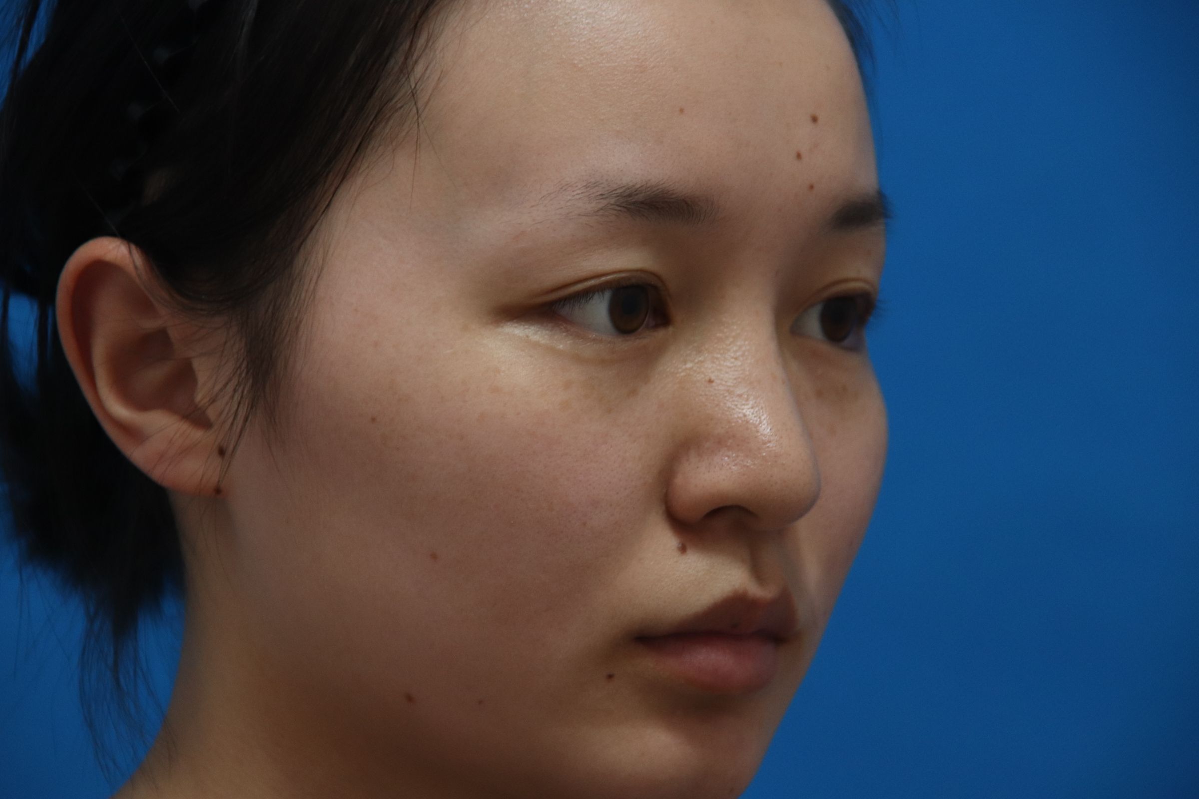 性成瘾症症状容易治疗吗,性成瘾症是不是精神疾病