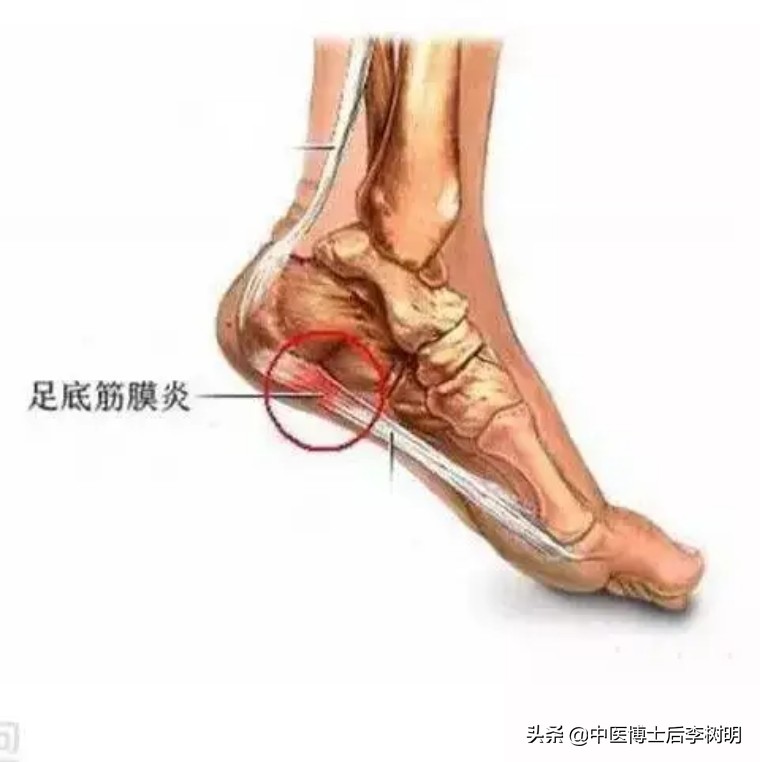 久站腰疼运动后缓解,久站走路足跟痛怎么办