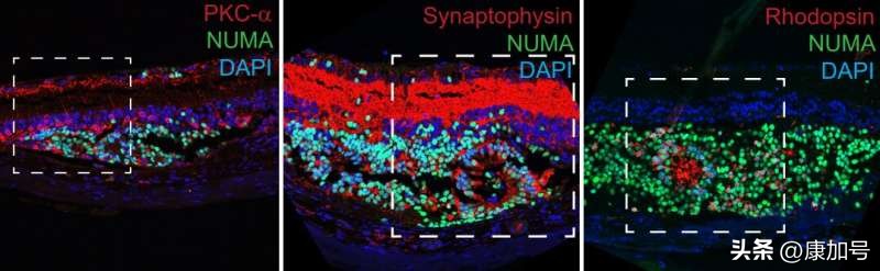 干细胞可以治疗失明吗,干细胞治疗青光眼失明