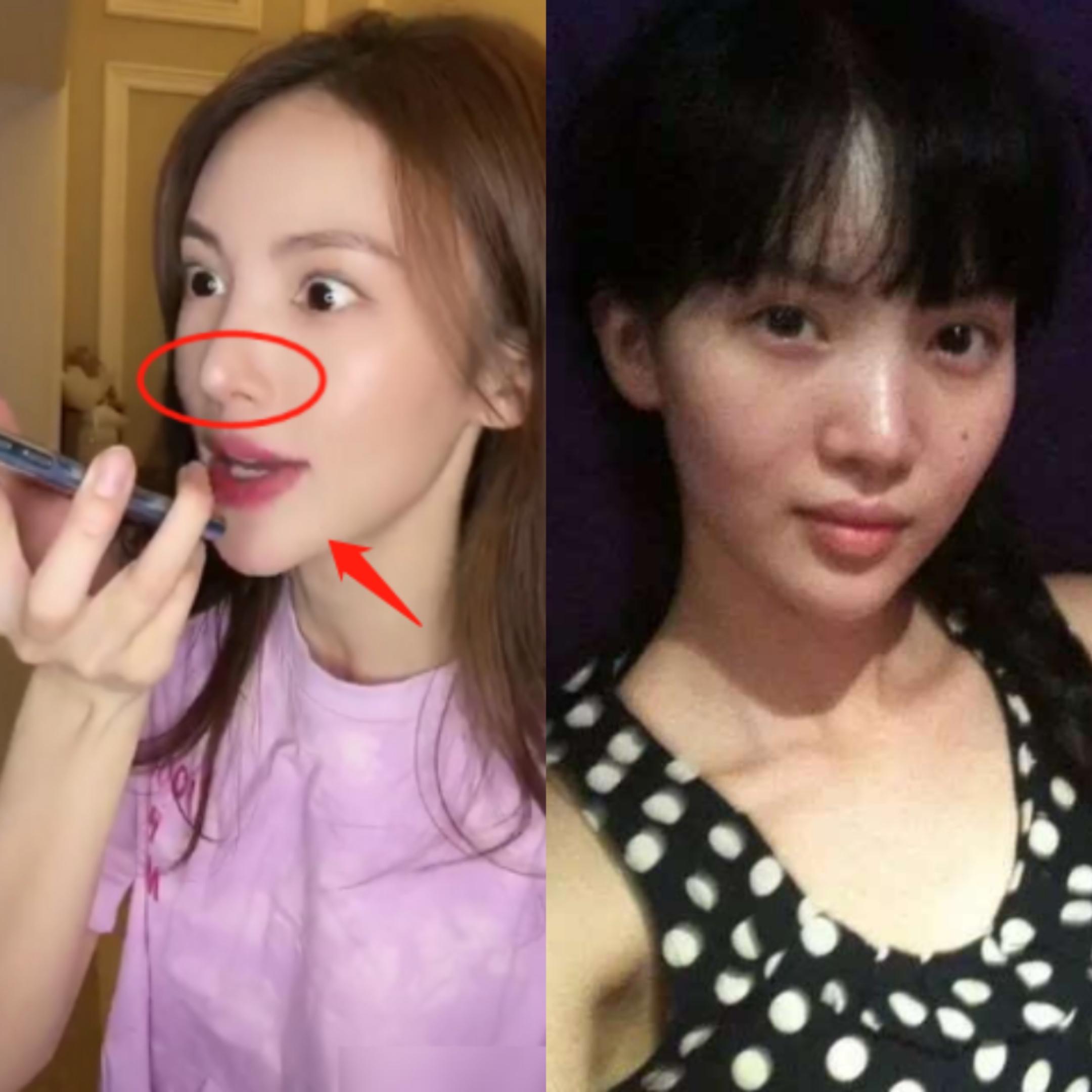 整容失败的女星蛇精脸,女星整容失败脸歪嘴斜